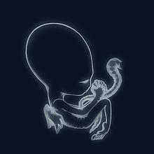 56-220px-ÁgætisByrjunCover